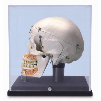 Deluxe Human Dental Skull, , with display globe A27/9